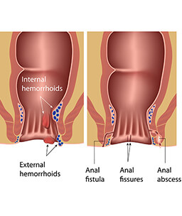 Dr.Samir Website Proctology Services Detailed