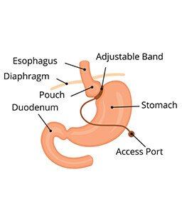 Dr.Samir Website Gastric Banding Services Detailed