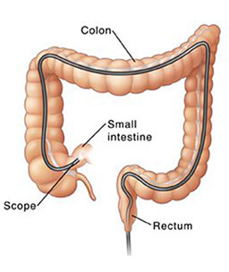 Dr.Samir Website Lower Endoscopy Services Detailed