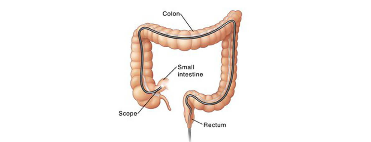 Dr.Samir Website Lower Endoscopy Services Detailed