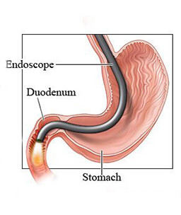 Dr.Samir Website Upper Endoscopy Services Detailed