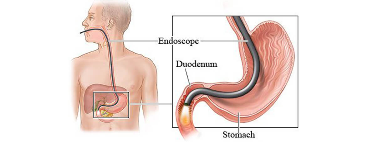 Dr.Samir Website Upper Endoscopy Services Detailed