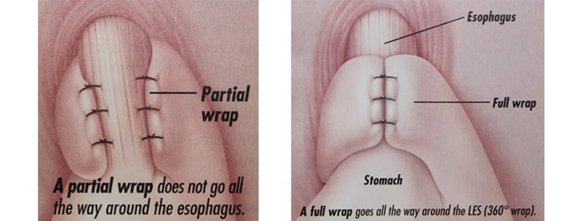 Dr.Samir Website Antireflux Services Detailed